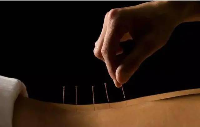 平衡針灸最新視頻，現代應用探索針灸藝術(shù)的新境界