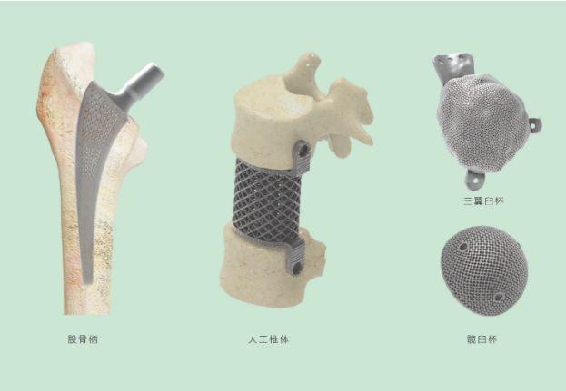 三維打印髖關(guān)節技術(shù)新動(dòng)態(tài)，重塑生活的科技魔法奇跡