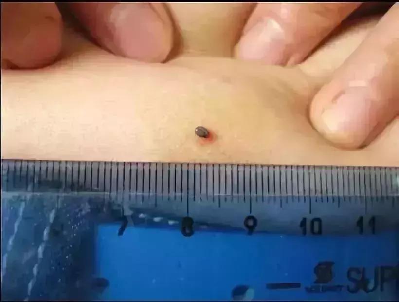 小明快樂(lè )疫情日志，最新疫情發(fā)布與日常觀(guān)察