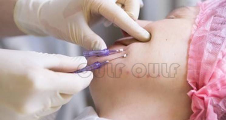 線(xiàn)雕最新手法，背景、發(fā)展、時(shí)代地位及展望